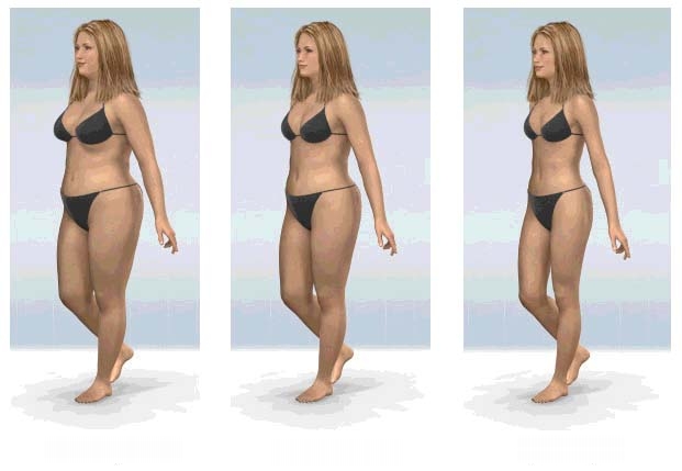 svorio metimas kakinant medžiagų apykaitos sutrikimai neleidžia numesti svorio